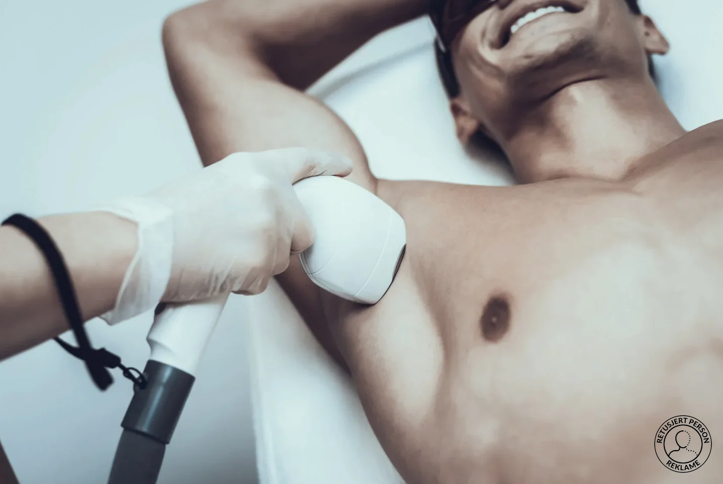 Laser hårfjerning armhule mann