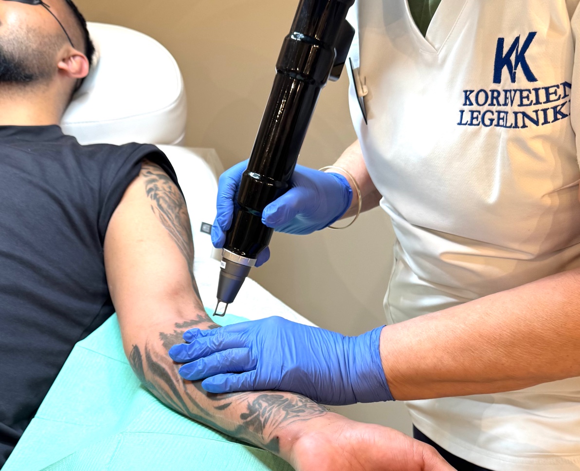 Behandler utfører tatoveringsfjerning med laser hos Korpeveien Legeklinikk i Drammen